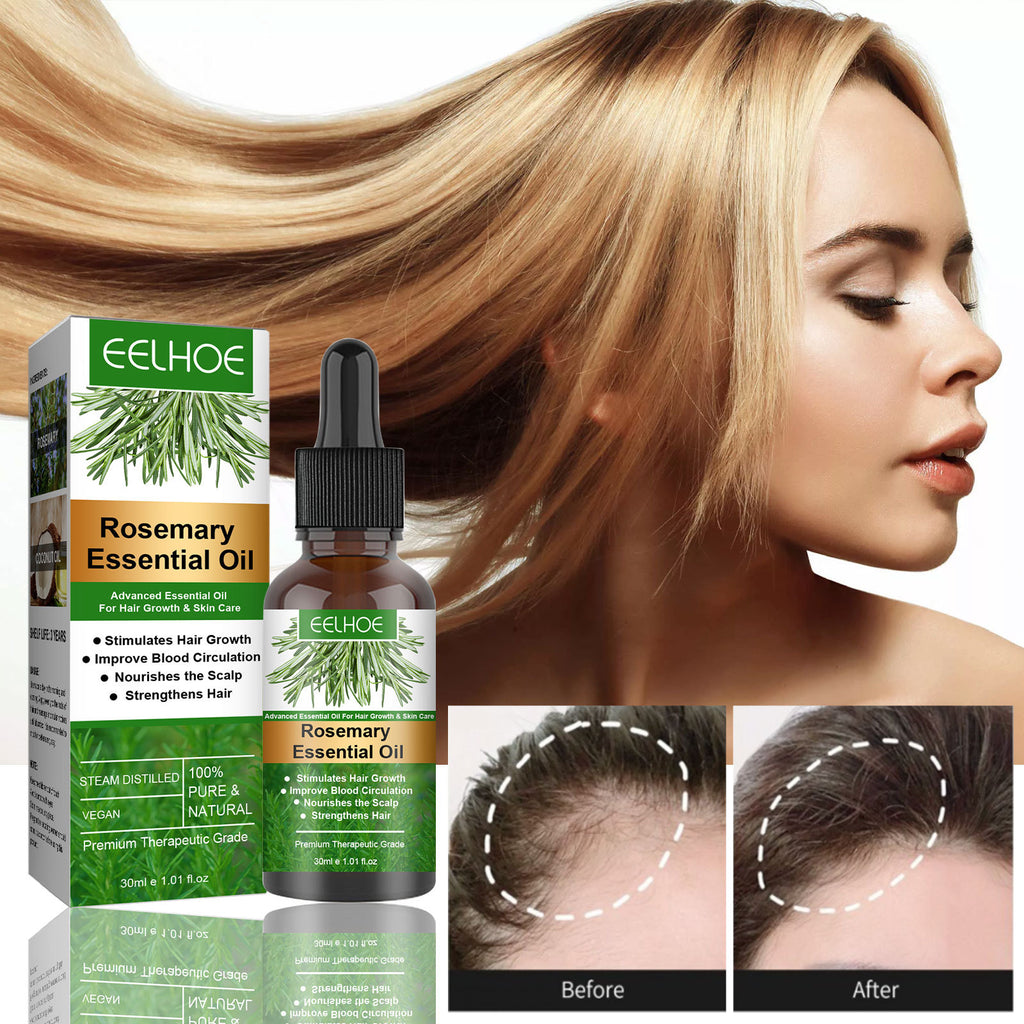 Rosemary Anti-Breakage Nourishing Hair Care Oil – Strengthening Scalp Treatment - Accrosstheglobe Store