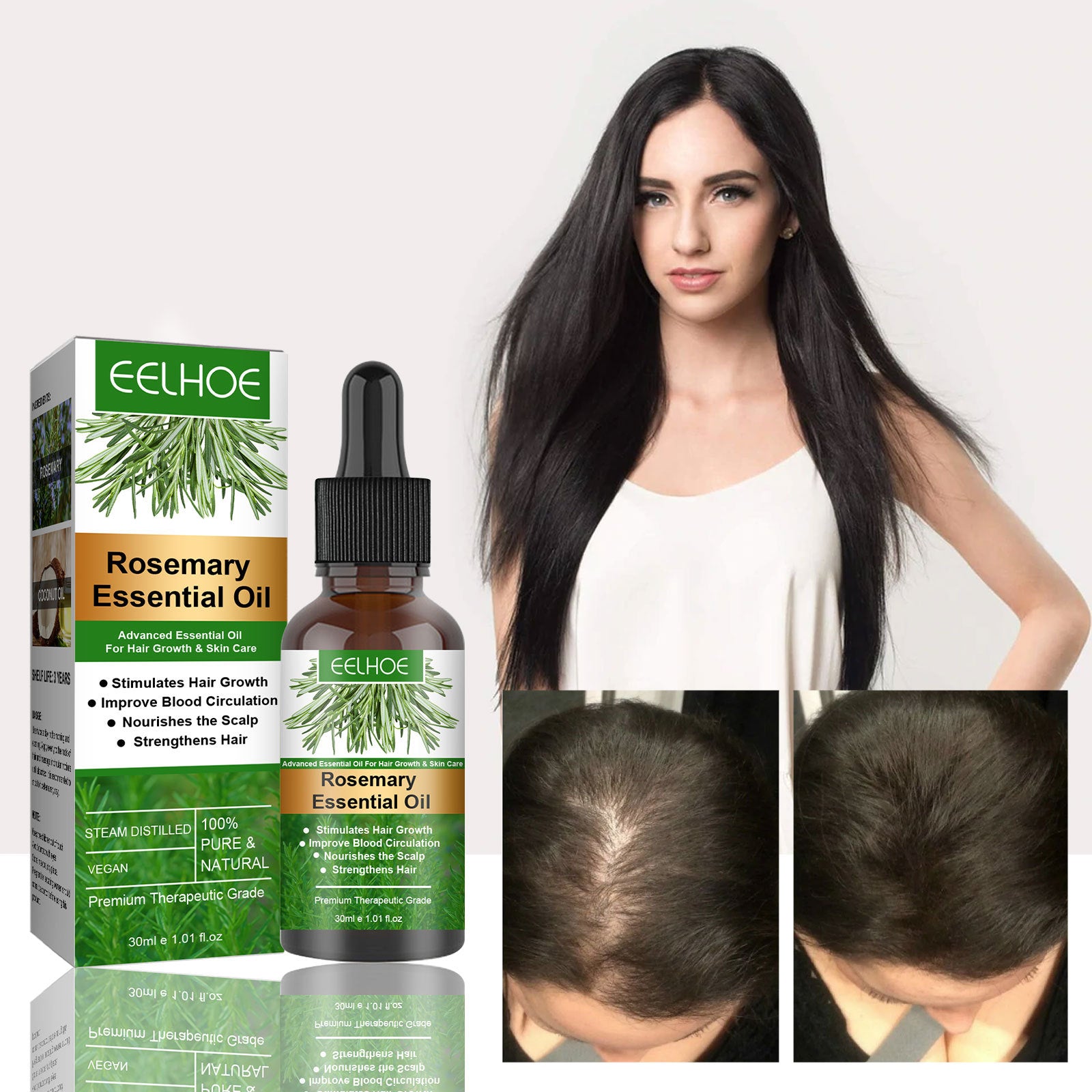 Rosemary Anti-Breakage Nourishing Hair Care Oil – Strengthening Scalp Treatment - Accrosstheglobe Store