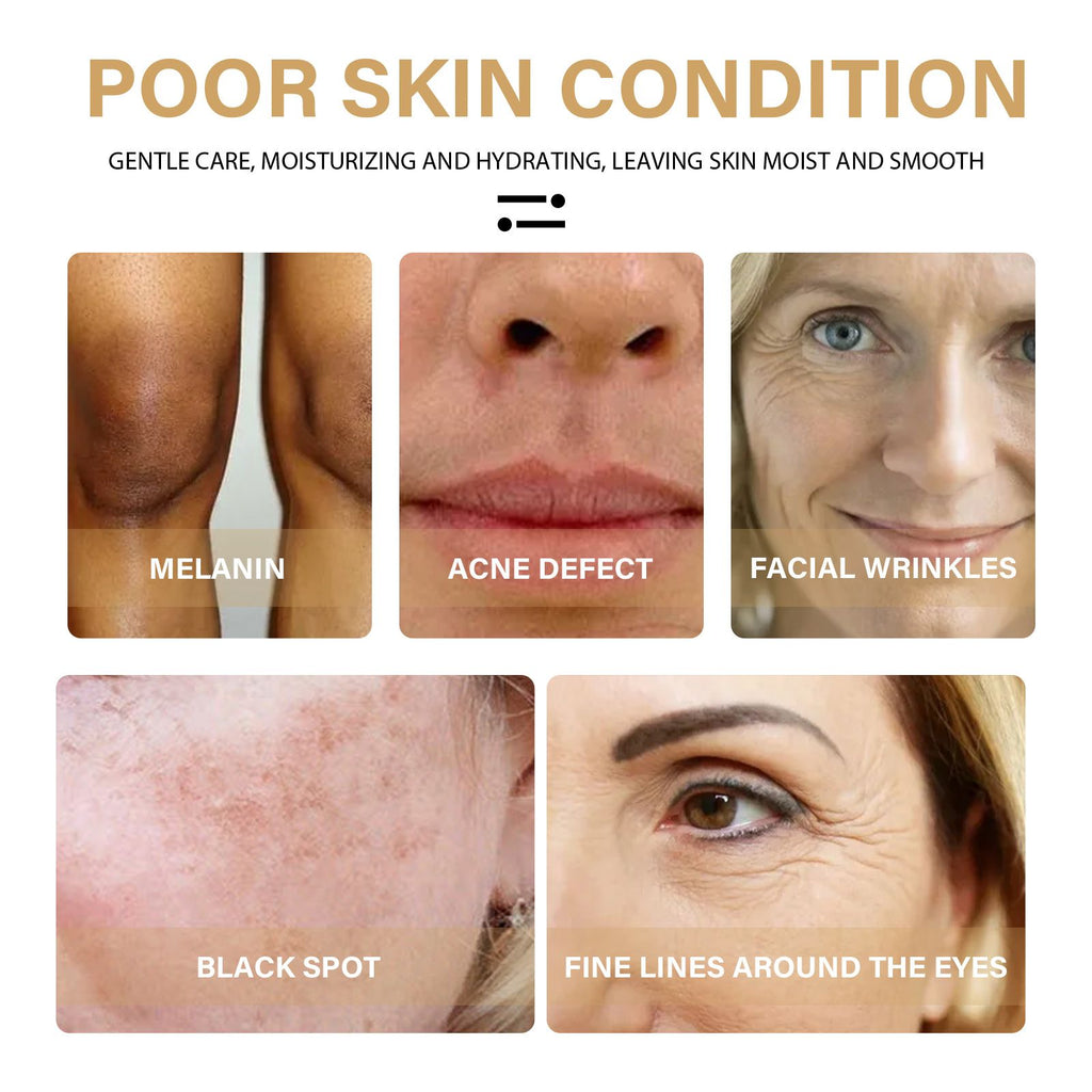 EELHOE Turmeric Dark Spot Correcting Serum – Brightening & Moisturizing Face Serum - Accrosstheglobe Store